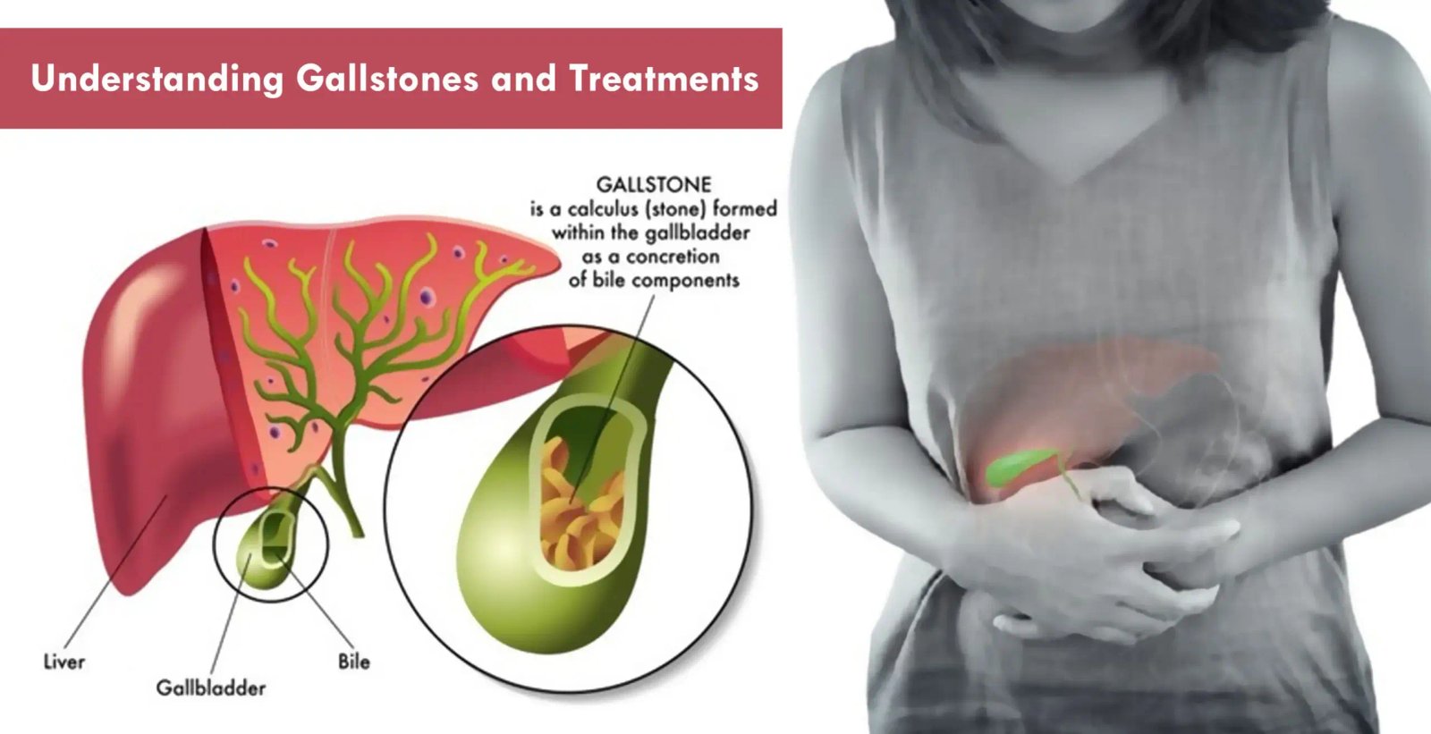 gall-stone